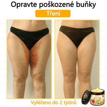 🐝Twisma® Krém s včelím jedem – doporučeno kožními lékaři 🧑‍⚕️ Na různé kožní problémy – fakt účinný a šetrný pomocník