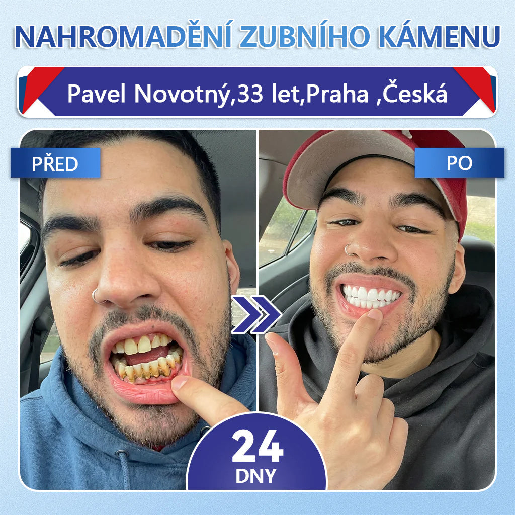 🦷 Glimmerly® Tideglusib Oral Strips – Pokročilá regenerace zubů a dásní | Aktivace kmenových buněk 🧬 | Obnova dentinu 💎 | Posílení skloviny ⚡ | Redukce citlivosti 💧 | Neinvazivní péče o úsměv ✨