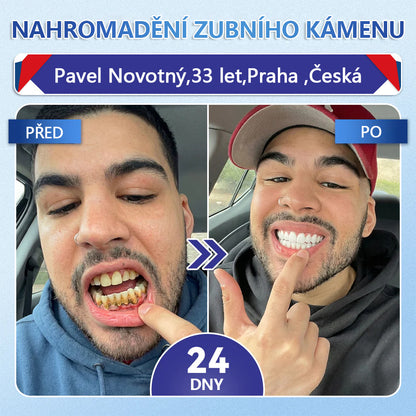 🦷 Glimmerly® Tideglusib Oral Strips – Pokročilá regenerace zubů a dásní | Aktivace kmenových buněk 🧬 | Obnova dentinu 💎 | Posílení skloviny ⚡ | Redukce citlivosti 💧 | Neinvazivní péče o úsměv ✨