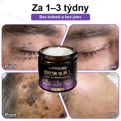 FOULME® Biotin 10-v-1 krém na obnovu pokožky ✨ – hydratační, anti-aging a regenerační péče o pleť 🧴 (kolagen 💧 + kyselina hyaluronová + rostlinné extrakty 🌿)