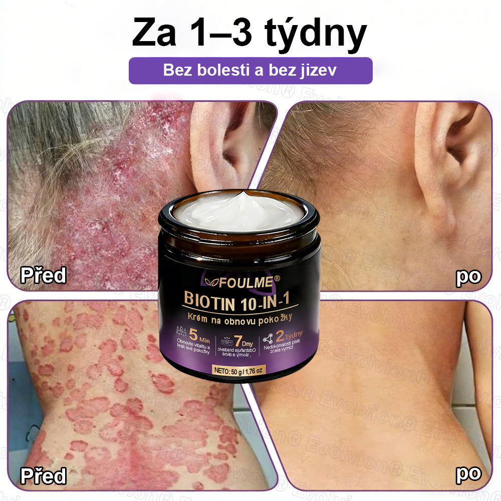 FOULME® Biotin 10-v-1 krém na obnovu pokožky ✨ – hydratační, anti-aging a regenerační péče o pleť 🧴 (kolagen 💧 + kyselina hyaluronová + rostlinné extrakty 🌿)