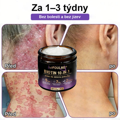 FOULME® Biotin 10-v-1 krém na obnovu pokožky ✨ – hydratační, anti-aging a regenerační péče o pleť 🧴 (kolagen 💧 + kyselina hyaluronová + rostlinné extrakty 🌿)