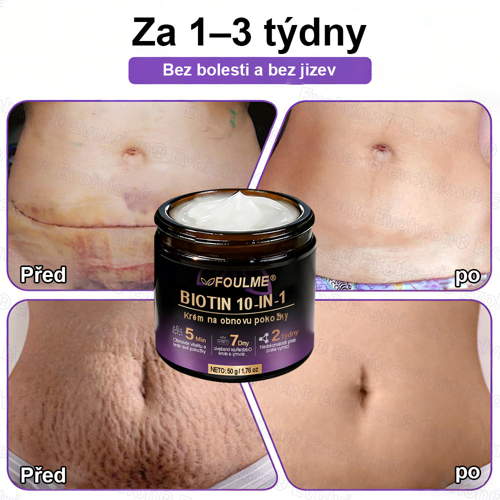 FOULME® Biotin 10-v-1 krém na obnovu pokožky ✨ – hydratační, anti-aging a regenerační péče o pleť 🧴 (kolagen 💧 + kyselina hyaluronová + rostlinné extrakty 🌿)