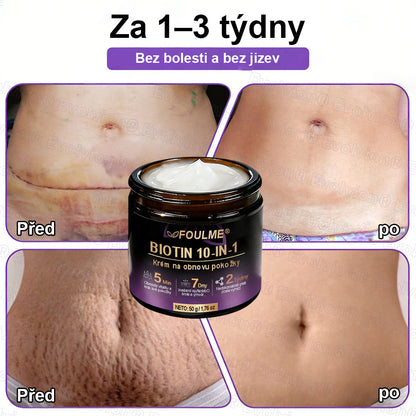 FOULME® Biotin 10-v-1 krém na obnovu pokožky ✨ – hydratační, anti-aging a regenerační péče o pleť 🧴 (kolagen 💧 + kyselina hyaluronová + rostlinné extrakty 🌿)