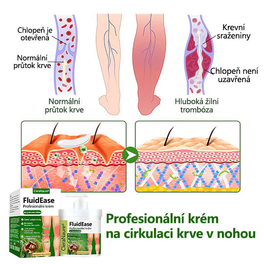 🌿 🌿Řekněte sbohem oteklým, bolestivým nohám – CleraNaure® FluidEase Profesionální krém pro prokrvení nohou přináší skutečnou úlevu! ✨🦵