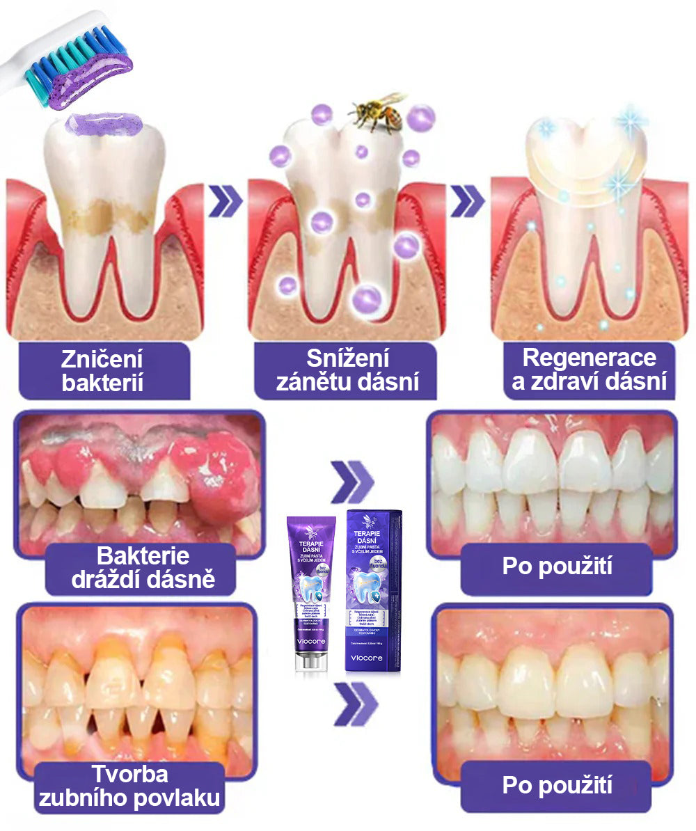 🌟 Twisma® VioCore Propolis zubní pasta 🦷 Úleva od bolesti zubů už za 3 dny · Obnova dásní během 7 dnů · Pomáhá předcházet parodontóze · Dokonalá kombinace včelího jedu a přírodních minerálů 🌟