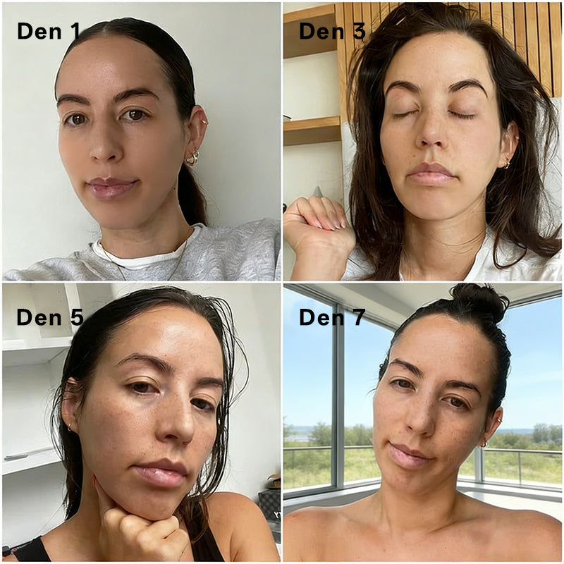 ✨ Pureo® revitalizační esenční krém s kmenovými buňkami, EGF a měděnými peptidy 💧 Podporuje regeneraci pokožky 🌿 Zpevňuje a vyhlazuje pleť ✨ Pro mladistvější vzhled 💖