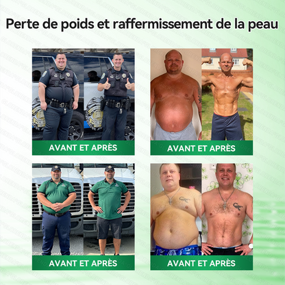 𝑩𝒐𝒖𝒕𝒊𝒒𝒖𝒆 𝒐𝒇𝒇𝒊𝒄𝒊𝒆𝒍𝒍𝒆 | 🌿🌿𝐆𝐋𝗢𝗥𝗘𝗡𝗗𝑨®𝑴𝒐𝒓𝒊𝐧𝐠𝙖 · 𝘽𝙚𝙧𝙗é𝙧𝒊𝒏𝒆 ×𝐍𝘼𝗗+ 𝟭0-𝒆𝒏-𝟏 𝐏𝐚𝙩𝙘𝙝 𝙈𝙞𝙘𝙧𝙤𝙣é𝙚𝒅𝒍𝒆 𝑨𝒗𝒂𝐧𝐜é 𝙉𝙖𝒏𝒐🇫🇷(𝐔𝐧𝐞 𝐬𝐞𝐮𝐥𝐞 𝐟𝐨𝐢𝐬 𝐩𝐚𝐫 𝐣𝐨𝐮𝐫, 𝐜𝐡𝐚𝐧𝐠𝐞𝐦𝐞𝐧𝐭𝐬 𝐯𝐢𝐬𝐢𝐛𝐥𝐞𝐬 𝐞𝐧 𝟕 𝐣𝐨𝐮𝐫𝐬） ✅ 𝐏𝐨𝐮𝐫 𝐥’𝐨𝐛é𝐬𝐢𝐭é, 🅟🅔🅐🅤 🅡🅔🅛â🅒🅗é🅔,𝐝𝐢𝐚𝐛è𝐭𝐞, 𝐚𝐩𝐧é𝐞 𝐝𝐮 𝐬𝐨𝐦𝐦𝐞𝐢𝐥, 𝐩𝐫𝐨𝐛𝐥è𝐦𝐞𝐬 𝐚𝐫𝐭𝐢𝐜𝐮𝐥𝐚𝐢𝐫𝐞𝐬, 𝐞𝐭 𝐛𝐢𝐞𝐧 𝐩𝐥𝐮𝐬