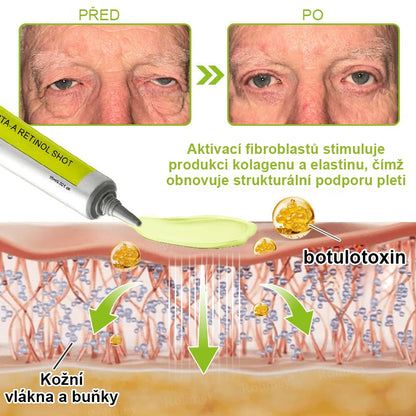 ✨ Vosxu™ Botox & Vita-A Retinol Shot sérum pro lifting vrásek ✨ – 💉 Mikrojehličky | 💪 Peptidy s účinkem botoxu | 🌿 Retinol | ⚡ Viditelné výsledky během 3 dnů 🌸