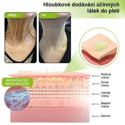 ✨ Vosxu™ Botox & Vita-A Retinol Shot sérum pro lifting vrásek ✨ – 💉 Mikrojehličky | 💪 Peptidy s účinkem botoxu | 🌿 Retinol | ⚡ Viditelné výsledky během 3 dnů 🌸