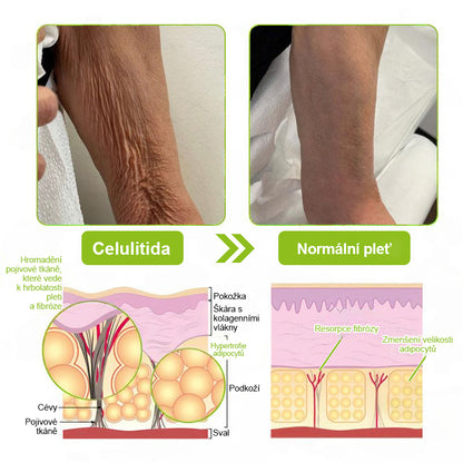 ✨ Vosxu™ Botox & Vita-A Retinol Shot sérum pro lifting vrásek ✨ – 💉 Mikrojehličky | 💪 Peptidy s účinkem botoxu | 🌿 Retinol | ⚡ Viditelné výsledky během 3 dnů 🌸