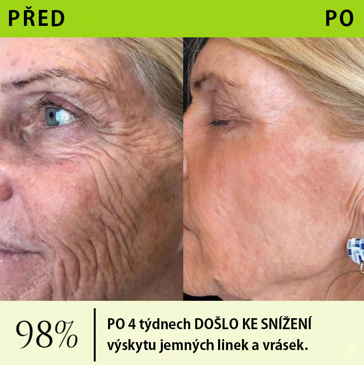 ✨ Vosxu™ Botox & Vita-A Retinol Shot sérum pro lifting vrásek ✨ – 💉 Mikrojehličky | 💪 Peptidy s účinkem botoxu | 🌿 Retinol | ⚡ Viditelné výsledky během 3 dnů 🌸