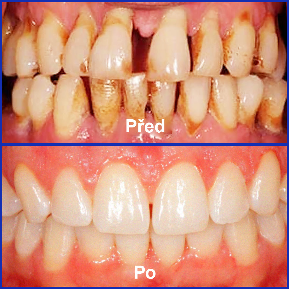 🌟 Twisma® VioCore Propolis zubní pasta 🦷 Úleva od bolesti zubů už za 3 dny · Obnova dásní během 7 dnů · Pomáhá předcházet parodontóze · Dokonalá kombinace včelího jedu a přírodních minerálů 🌟