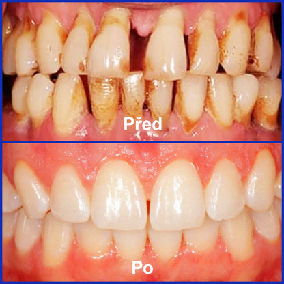 🌟 Twisma® VioCore Propolis zubní pasta 🦷 Úleva od bolesti zubů už za 3 dny · Obnova dásní během 7 dnů · Pomáhá předcházet parodontóze · Dokonalá kombinace včelího jedu a přírodních minerálů 🌟