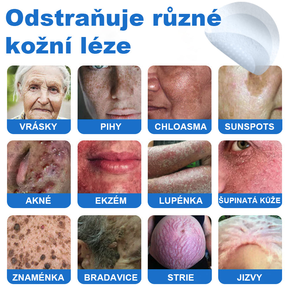 VeruDerm® 2v1 mikrojehličková a hydrokoloidní náplast | Cílená péče o kožní výrůstky, pupínky, ploché bradavice a drobné nedokonalosti ✅ | Pomáhá zjemnit vzhled vrásek, jizev a nerovností pleti ✨ | Diskrétní náplast na obličej i tělo | 144 ks