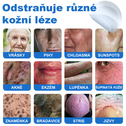 VeruDerm® 2v1 mikrojehličková a hydrokoloidní náplast | Cílená péče o kožní výrůstky, pupínky, ploché bradavice a drobné nedokonalosti ✅ | Pomáhá zjemnit vzhled vrásek, jizev a nerovností pleti ✨ | Diskrétní náplast na obličej i tělo | 144 ks