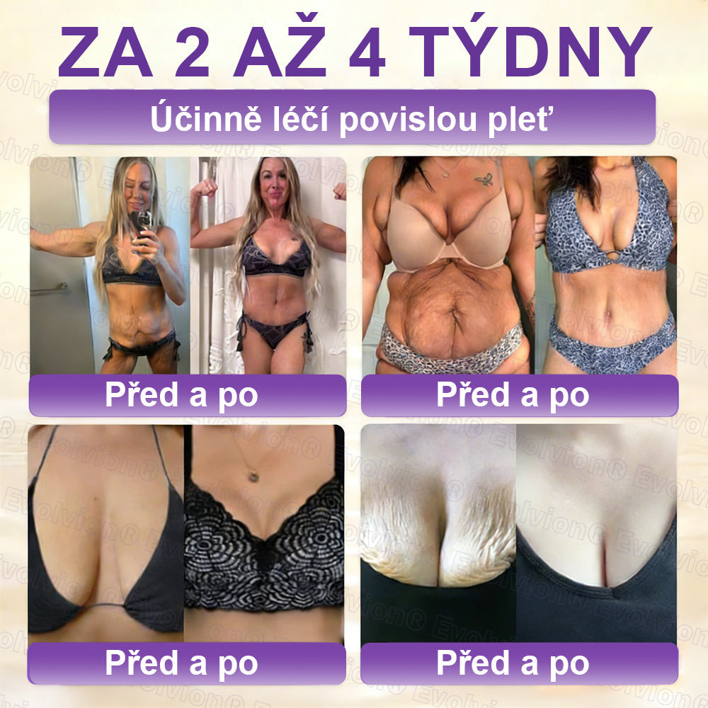 FOULME® Biotin 10-v-1 krém na obnovu pokožky ✨ – hydratační, anti-aging a regenerační péče o pleť 🧴 (kolagen 💧 + kyselina hyaluronová + rostlinné extrakty 🌿)