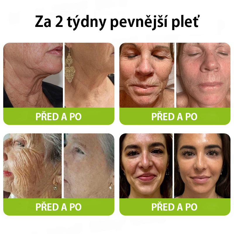 ✨ Vosxu™ Botox & Vita-A Retinol Shot sérum pro lifting vrásek ✨ – 💉 Mikrojehličky | 💪 Peptidy s účinkem botoxu | 🌿 Retinol | ⚡ Viditelné výsledky během 3 dnů 🌸