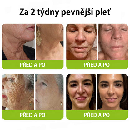 ✨ Vosxu™ Botox & Vita-A Retinol Shot sérum pro lifting vrásek ✨ – 💉 Mikrojehličky | 💪 Peptidy s účinkem botoxu | 🌿 Retinol | ⚡ Viditelné výsledky během 3 dnů 🌸