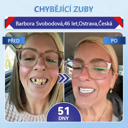 🦷 Glimmerly® Tideglusib Oral Strips – Pokročilá regenerace zubů a dásní | Aktivace kmenových buněk 🧬 | Obnova dentinu 💎 | Posílení skloviny ⚡ | Redukce citlivosti 💧 | Neinvazivní péče o úsměv ✨