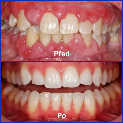 🌟 Twisma® VioCore Propolis zubní pasta 🦷 Úleva od bolesti zubů už za 3 dny · Obnova dásní během 7 dnů · Pomáhá předcházet parodontóze · Dokonalá kombinace včelího jedu a přírodních minerálů 🌟