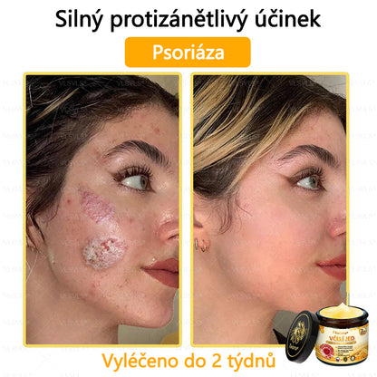 🐝Twisma® Krém s včelím jedem – doporučeno kožními lékaři 🧑‍⚕️ Na různé kožní problémy – fakt účinný a šetrný pomocník