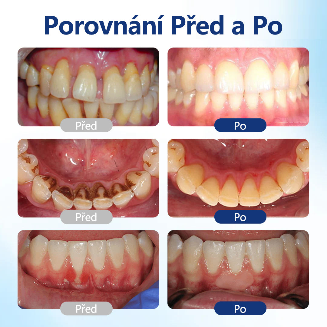 CleraNaure® BeeTakt kapky pro péči o zuby s včelím jedem 🦷 🌿 Pokročilé řešení pro obnovu dásní a ústní zdraví 🛡️ Odstraňování zubního plaku | Regenerace dásní | Úleva od citlivosti