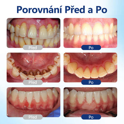 CleraNaure® BeeTakt kapky pro péči o zuby s včelím jedem 🦷 🌿 Pokročilé řešení pro obnovu dásní a ústní zdraví 🛡️ Odstraňování zubního plaku | Regenerace dásní | Úleva od citlivosti