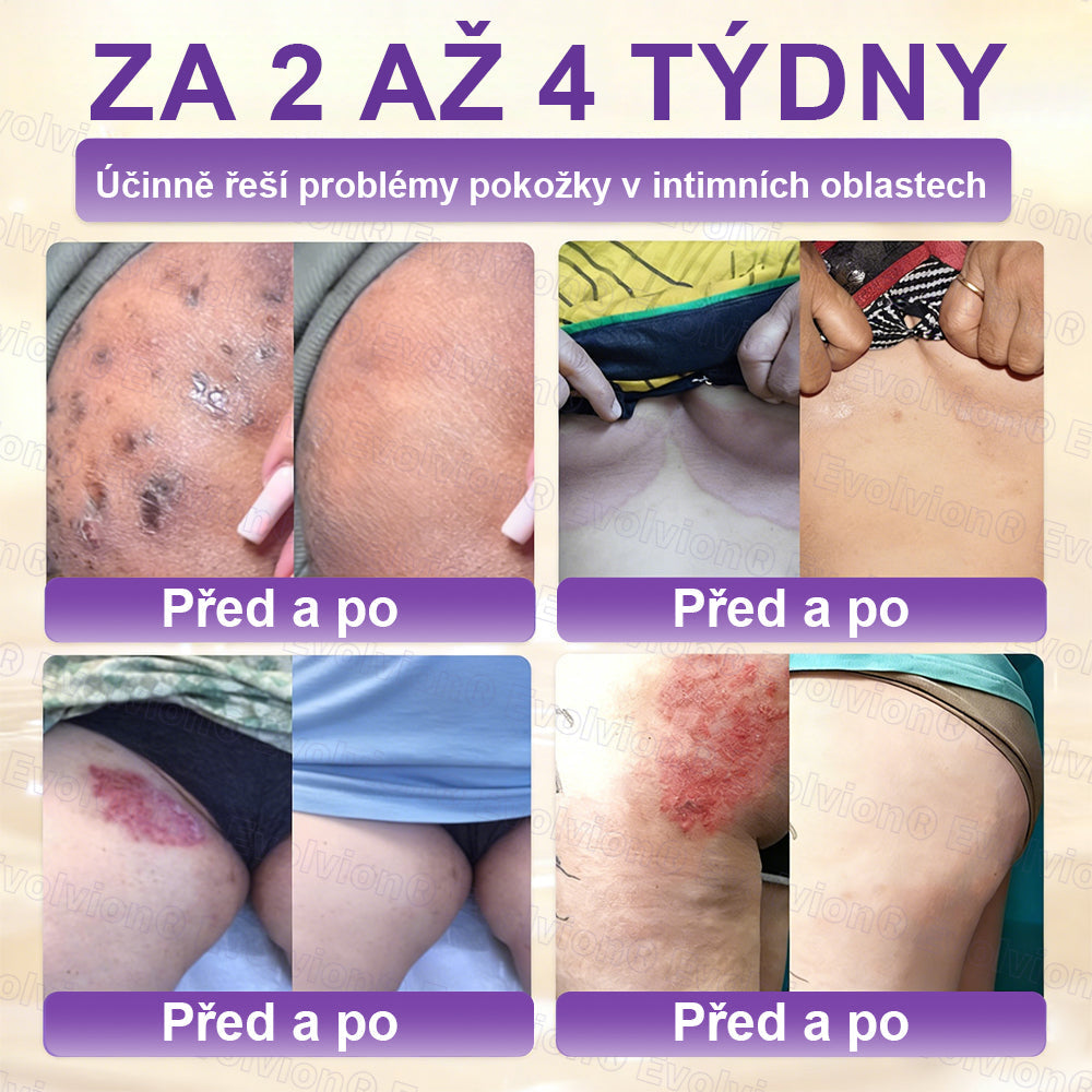 FOULME® Biotin 10-v-1 krém na obnovu pokožky ✨ – hydratační, anti-aging a regenerační péče o pleť 🧴 (kolagen 💧 + kyselina hyaluronová + rostlinné extrakty 🌿)