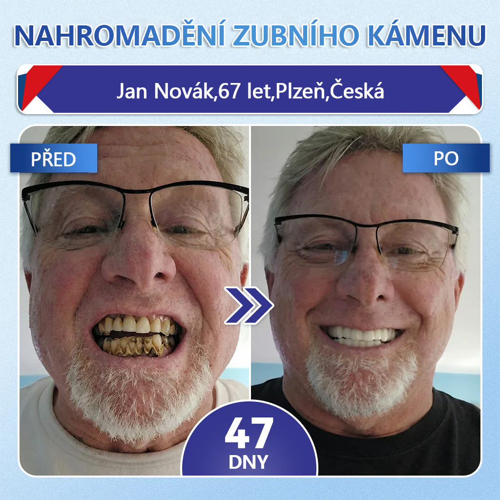 🦷 Glimmerly® Tideglusib Oral Strips – Pokročilá regenerace zubů a dásní | Aktivace kmenových buněk 🧬 | Obnova dentinu 💎 | Posílení skloviny ⚡ | Redukce citlivosti 💧 | Neinvazivní péče o úsměv ✨