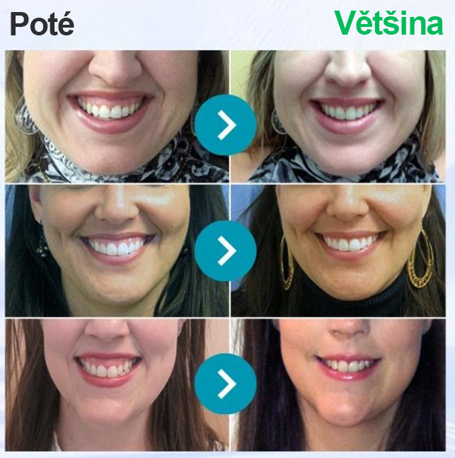 🌟 Twisma® VioCore Propolis zubní pasta 🦷 Úleva od bolesti zubů už za 3 dny · Obnova dásní během 7 dnů · Pomáhá předcházet parodontóze · Dokonalá kombinace včelího jedu a přírodních minerálů 🌟