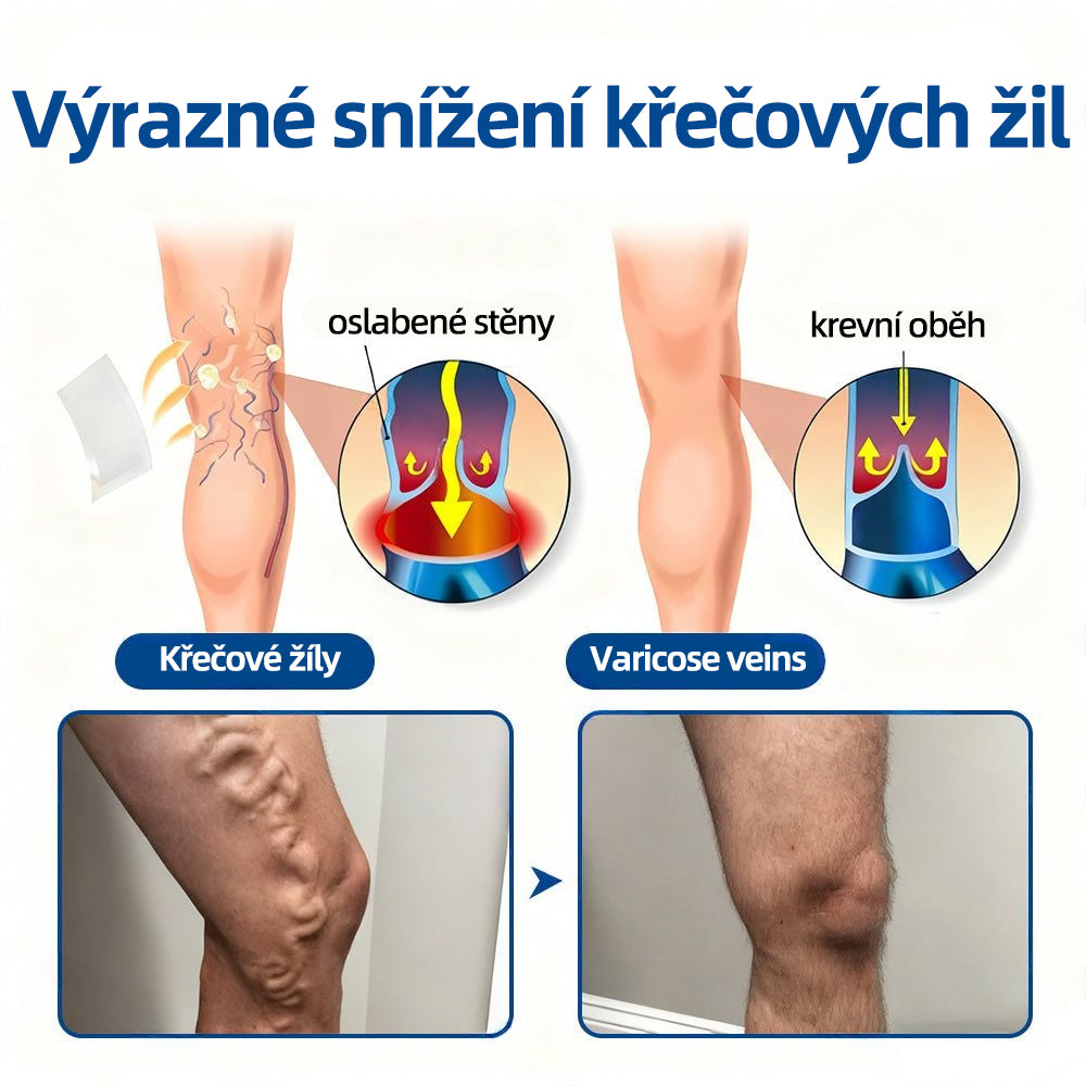 𝑯𝒆𝒂𝒍𝒓𝒊𝒛𝒆® 𝑽𝒆𝒊𝒏𝑻𝒂𝒓𝒈𝒆𝒕 𝒎𝒊𝒌𝒓𝒐𝒋𝒊𝒉𝒍𝒐𝒗á 𝒏á𝒑𝒍𝒂𝒔ť 🌸 96 % klinicky prokázaná účinnost ⚡ Viditelné výsledky už za 7–14 dní 🌿 Šetrná podpora pro lehčí a uvolněnější nohy🌙