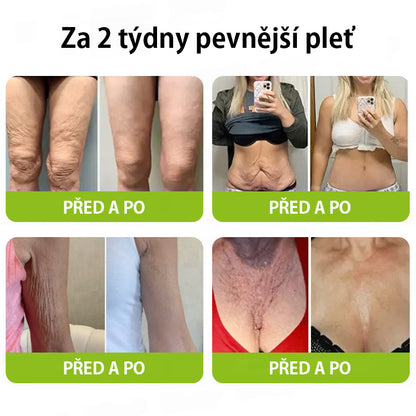 ✨ Vosxu™ Botox & Vita-A Retinol Shot sérum pro lifting vrásek ✨ – 💉 Mikrojehličky | 💪 Peptidy s účinkem botoxu | 🌿 Retinol | ⚡ Viditelné výsledky během 3 dnů 🌸