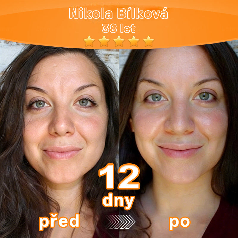 ✨ Pureo® revitalizační esenční krém s kmenovými buňkami, EGF a měděnými peptidy 💧 Podporuje regeneraci pokožky 🌿 Zpevňuje a vyhlazuje pleť ✨ Pro mladistvější vzhled 💖