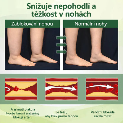 🌿 🌿Řekněte sbohem oteklým, bolestivým nohám – CleraNaure® FluidEase Profesionální krém pro prokrvení nohou přináší skutečnou úlevu! ✨🦵