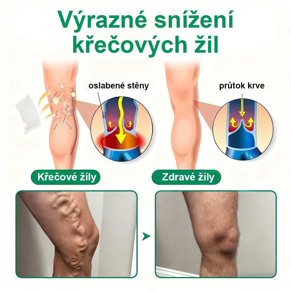 ✨ Twisma® VeinTarget – Pokročilá mikro náplast na křečové žíly 🔥 96 % klinicky prokázaná účinnost ⚡ Viditelné výsledky už za 7–14 dní 🌿 Šetrná podpora pro lehčí a uvolněnější nohy 🦵💪