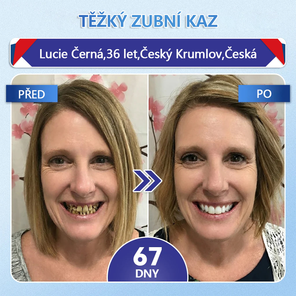 🦷 Glimmerly® Tideglusib Oral Strips – Pokročilá regenerace zubů a dásní | Aktivace kmenových buněk 🧬 | Obnova dentinu 💎 | Posílení skloviny ⚡ | Redukce citlivosti 💧 | Neinvazivní péče o úsměv ✨