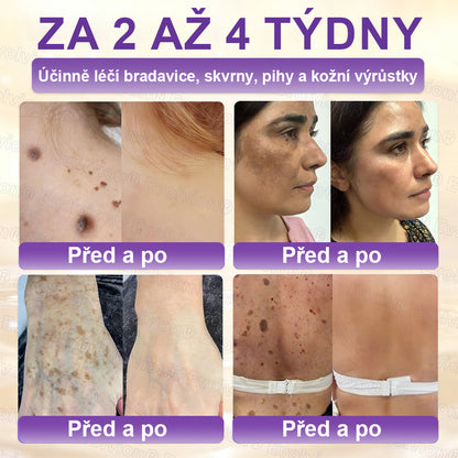 FOULME® Biotin 10-v-1 krém na obnovu pokožky ✨ – hydratační, anti-aging a regenerační péče o pleť 🧴 (kolagen 💧 + kyselina hyaluronová + rostlinné extrakty 🌿)