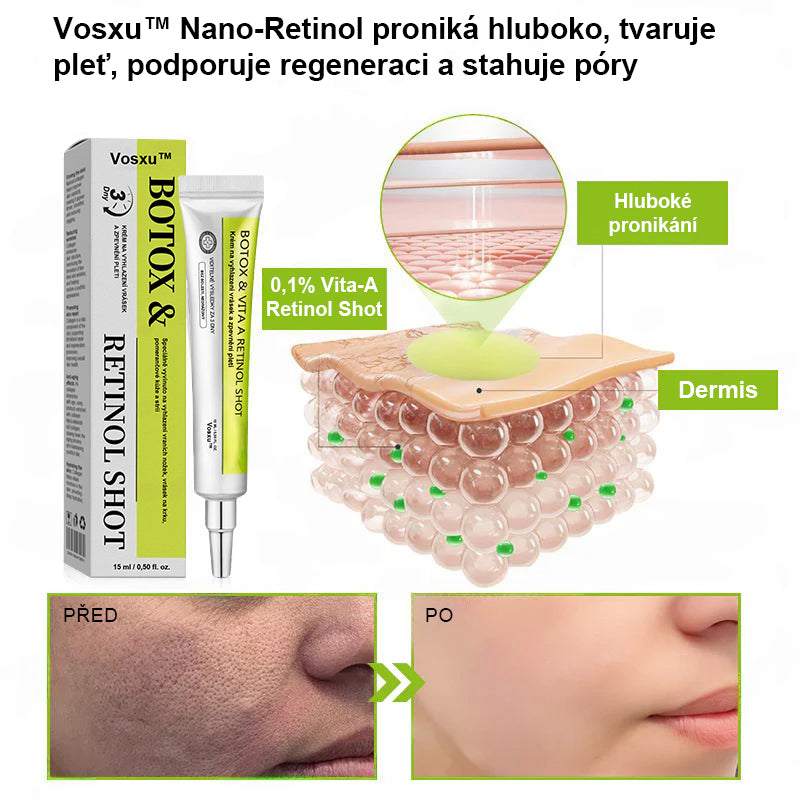 ✨ Vosxu™ Botox & Vita-A Retinol Shot sérum pro lifting vrásek ✨ – 💉 Mikrojehličky | 💪 Peptidy s účinkem botoxu | 🌿 Retinol | ⚡ Viditelné výsledky během 3 dnů 🌸