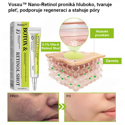 ✨ Vosxu™ Botox & Vita-A Retinol Shot sérum pro lifting vrásek ✨ – 💉 Mikrojehličky | 💪 Peptidy s účinkem botoxu | 🌿 Retinol | ⚡ Viditelné výsledky během 3 dnů 🌸