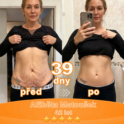 ✨ Pureo® revitalizační esenční krém s kmenovými buňkami, EGF a měděnými peptidy 💧 Podporuje regeneraci pokožky 🌿 Zpevňuje a vyhlazuje pleť ✨ Pro mladistvější vzhled 💖