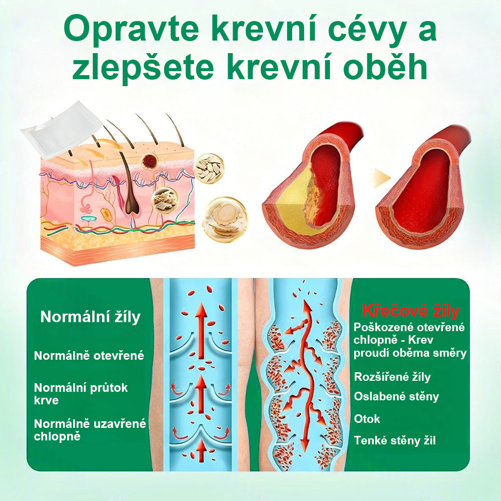 ✨ Twisma® VeinTarget – Pokročilá mikro náplast na křečové žíly 🔥 96 % klinicky prokázaná účinnost ⚡ Viditelné výsledky už za 7–14 dní 🌿 Šetrná podpora pro lehčí a uvolněnější nohy 🦵💪