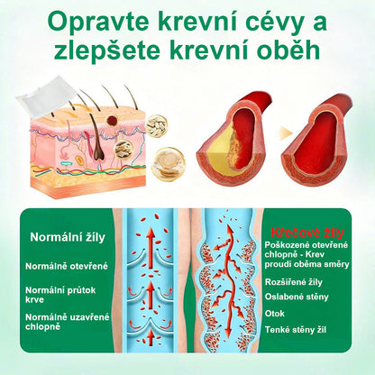 ✨ Twisma® VeinTarget – Pokročilá mikro náplast na křečové žíly 🔥 96 % klinicky prokázaná účinnost ⚡ Viditelné výsledky už za 7–14 dní 🌿 Šetrná podpora pro lehčí a uvolněnější nohy 🦵💪
