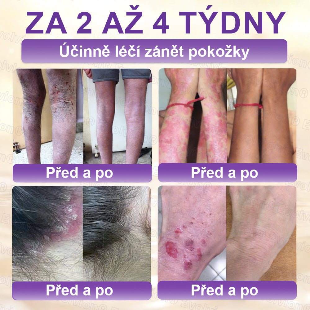 FOULME® Biotin 10-v-1 krém na obnovu pokožky ✨ – hydratační, anti-aging a regenerační péče o pleť 🧴 (kolagen 💧 + kyselina hyaluronová + rostlinné extrakty 🌿)