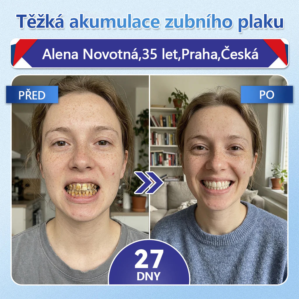 🦷 Glimmerly® Tideglusib Oral Strips – Pokročilá regenerace zubů a dásní | Aktivace kmenových buněk 🧬 | Obnova dentinu 💎 | Posílení skloviny ⚡ | Redukce citlivosti 💧 | Neinvazivní péče o úsměv ✨