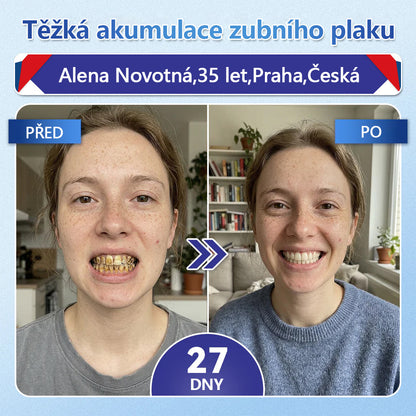 🦷 Glimmerly® Tideglusib Oral Strips – Pokročilá regenerace zubů a dásní | Aktivace kmenových buněk 🧬 | Obnova dentinu 💎 | Posílení skloviny ⚡ | Redukce citlivosti 💧 | Neinvazivní péče o úsměv ✨