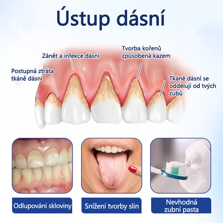 CleraNaure® BeeTakt kapky pro péči o zuby s včelím jedem 🦷 🌿 Pokročilé řešení pro obnovu dásní a ústní zdraví 🛡️ Odstraňování zubního plaku | Regenerace dásní | Úleva od citlivosti