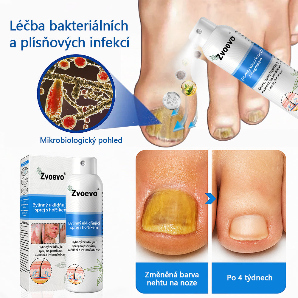 💪 Oficiální obchod: Twisma® Magnesium bylinný sprej na lupénku ✅ CE certifikace (zmírňuje lupénku a ekzém, léčí akné a bradavice, podporuje hojení bakteriálních infekcí, snižuje kloubní a neuropatickou bolest)