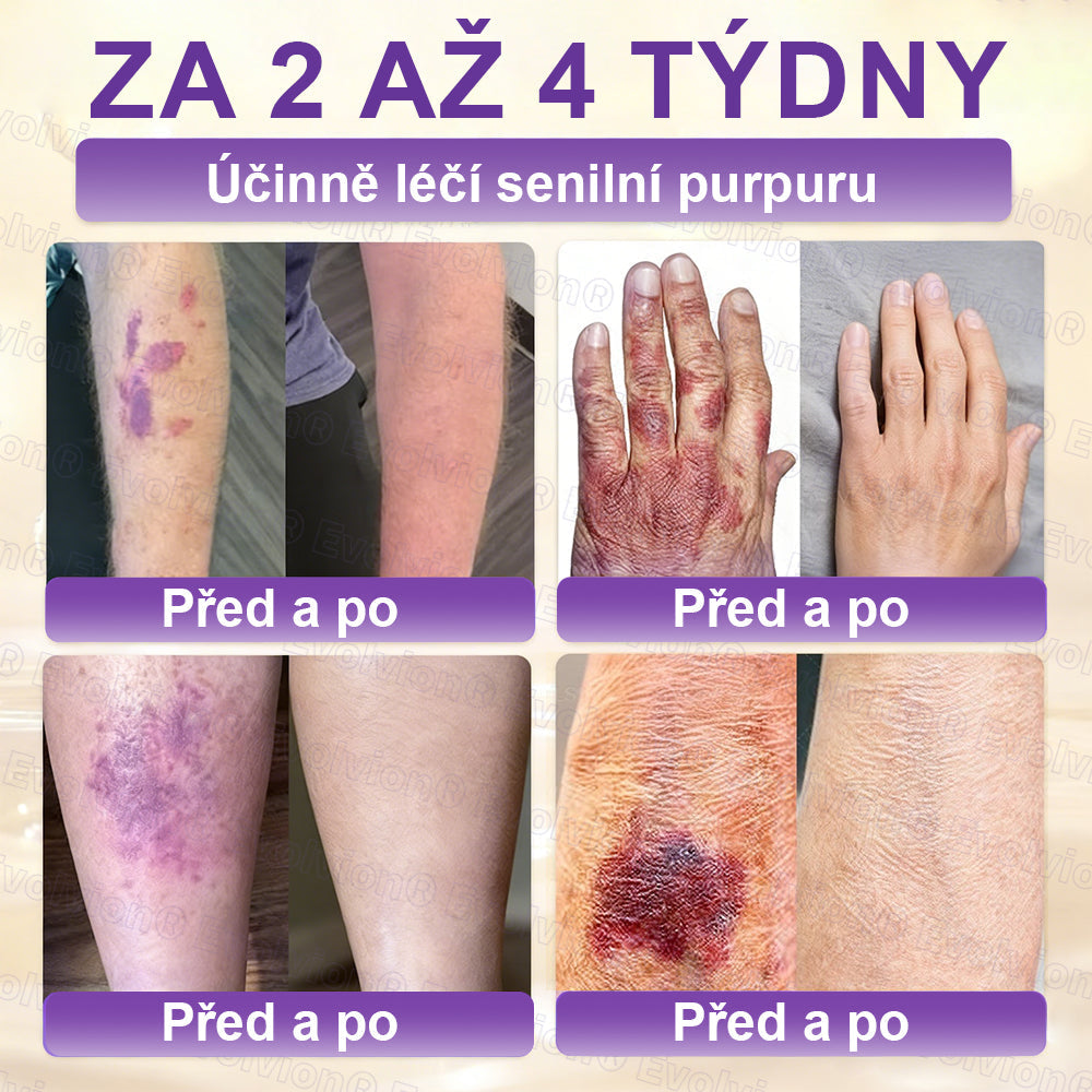 FOULME® Biotin 10-v-1 krém na obnovu pokožky ✨ – hydratační, anti-aging a regenerační péče o pleť 🧴 (kolagen 💧 + kyselina hyaluronová + rostlinné extrakty 🌿)