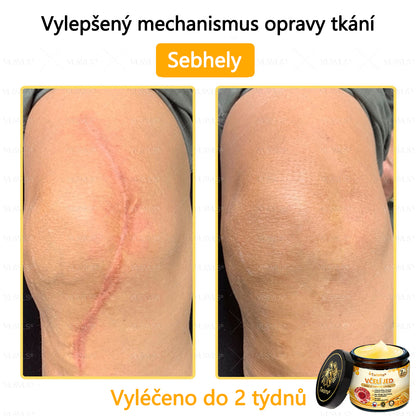 🐝Twisma® Krém s včelím jedem – doporučeno kožními lékaři 🧑‍⚕️ Na různé kožní problémy – fakt účinný a šetrný pomocník
